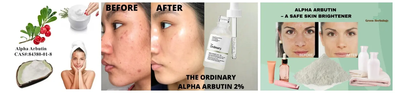 Alpha Arbutin - Nga painga me nga whakamahinga.webp